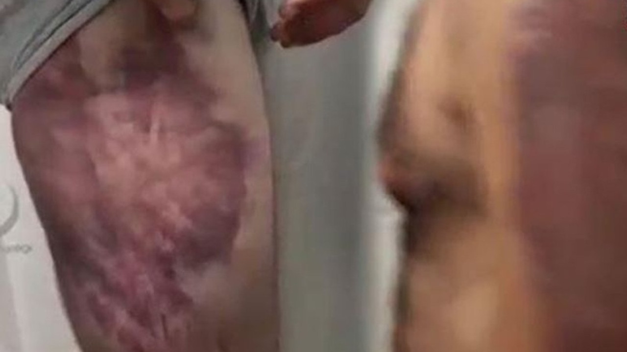 İşkenceden sonra soruşturmaya da takipsizlik kararı