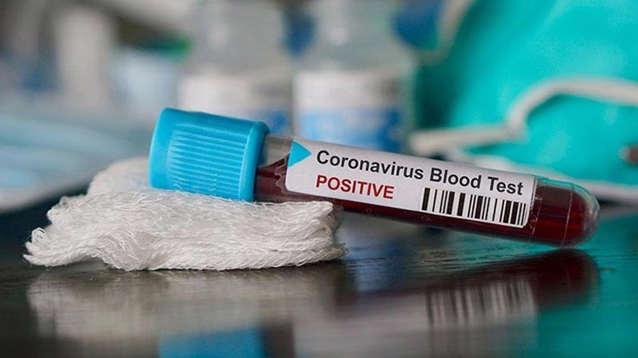 Türkiye'nin coronavirus tablosu: Can kaybı toplamda 4.431