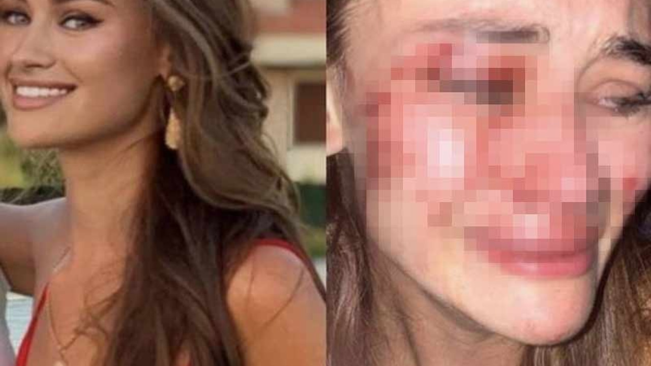 Ünlü model İzmir'de güvenlik görevlilerin saldırısına uğradı