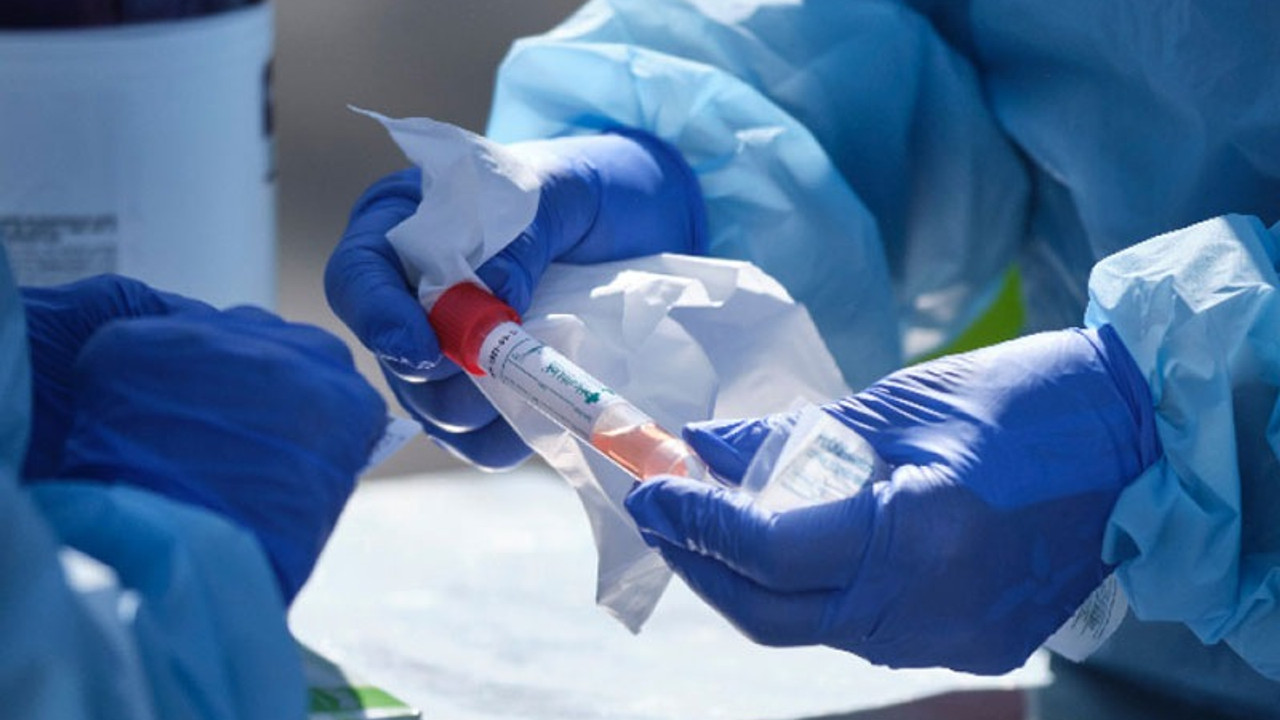 Coronavirus tablosu: 193 vefat, 31.923 pozitif vaka