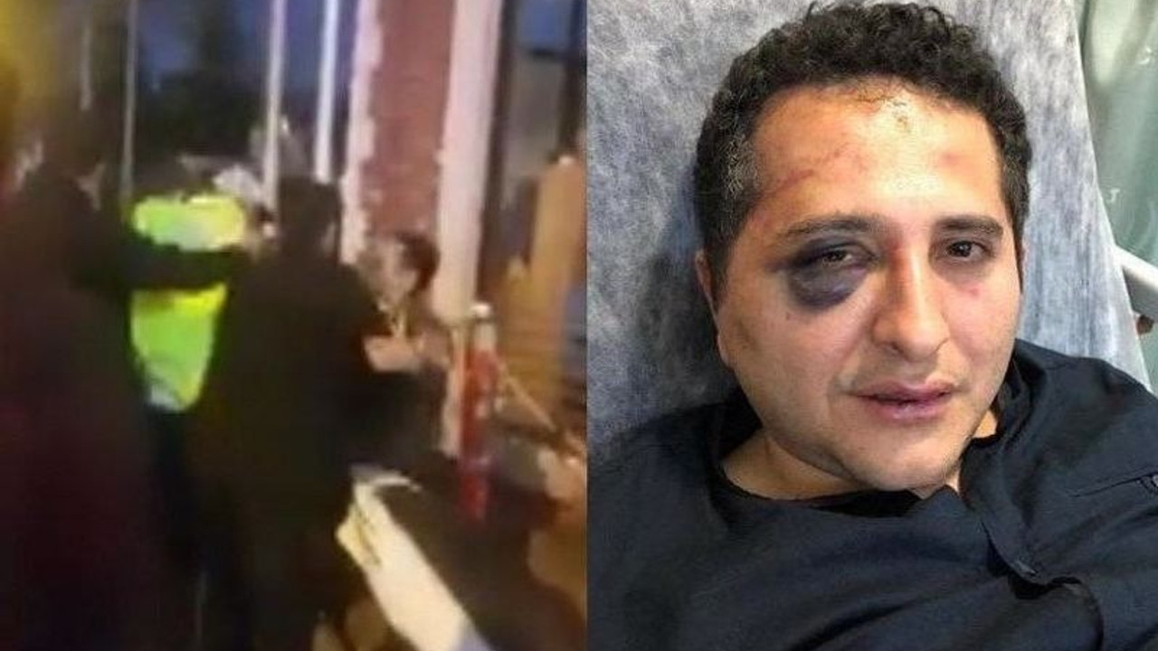 Avukat Sürenoğlu'nu darp eden Cumhurbaşkanlığı korumaları: Kendini sağa sola vurdu