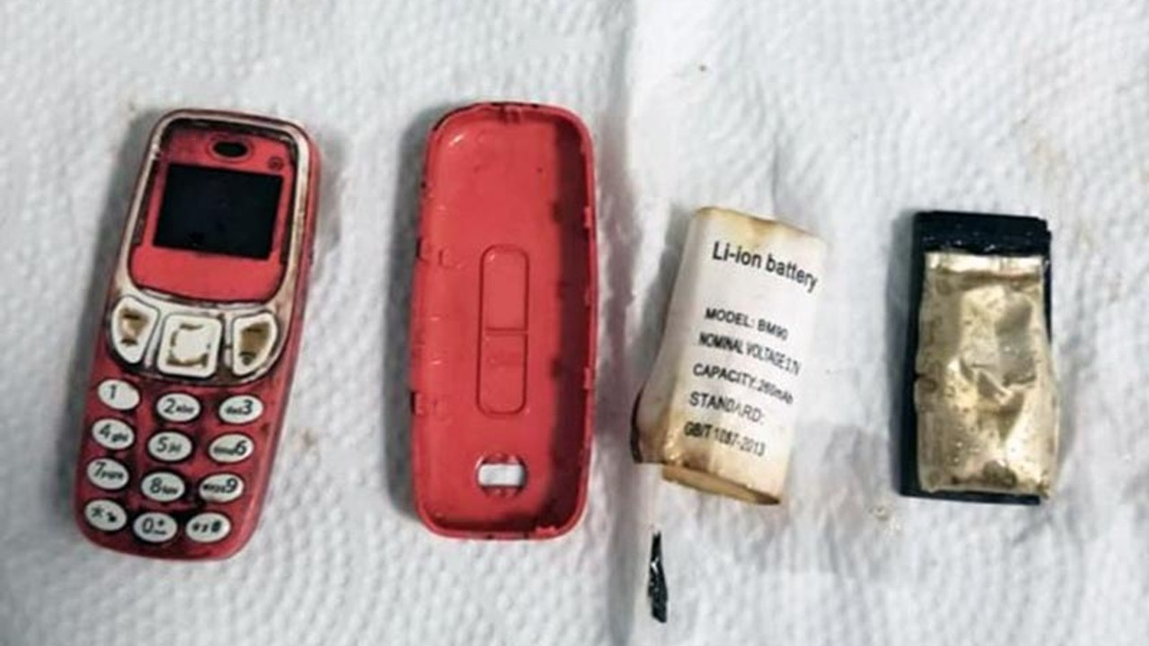 Bir kişinin midesinden Nokia 3310 çıkarıldı