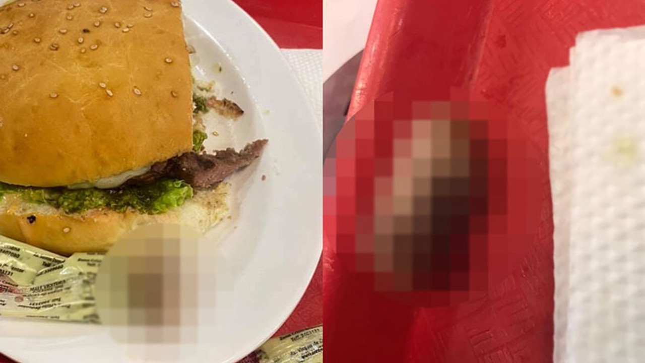 Hamburgerin içinden insan parmağı çıktı