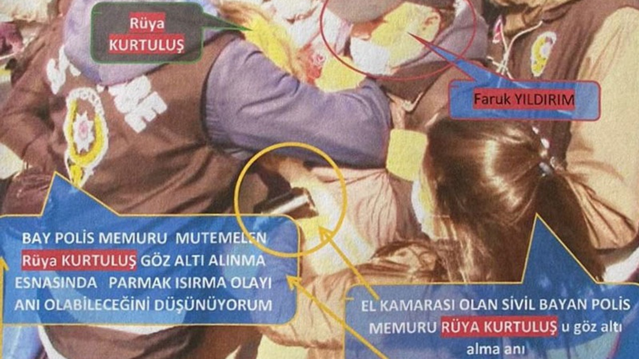 Polis ‘parmağımı ısırdı’ dedi, bilirkişi raporunu başka bir polis verdi, savcı 3 yıl hapis istedi