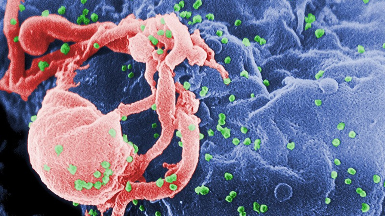 HIV enfeksiyonunun son 10 yılda yüzde 460 arttığı tek ülke Türkiye