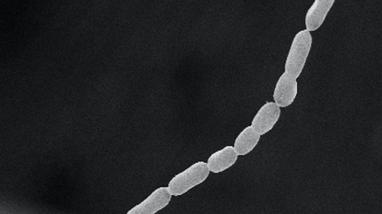 Dünyanın çıplak gözle de görülebilen en büyük bakterisi keşfedildi