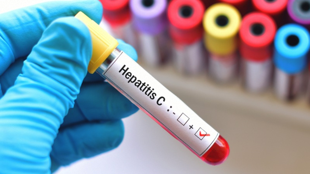 Hepatit: 2 dakikada 1 kişiyi öldürüyor, yüzbinlerce kişi taşıyıcı olduğunu bile bilmiyor