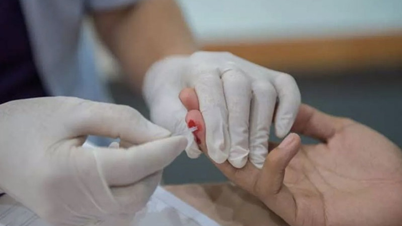 Türkiye’de son üç yılda HIV tanısı alan kişilerin sayısı 10 bine ulaştı