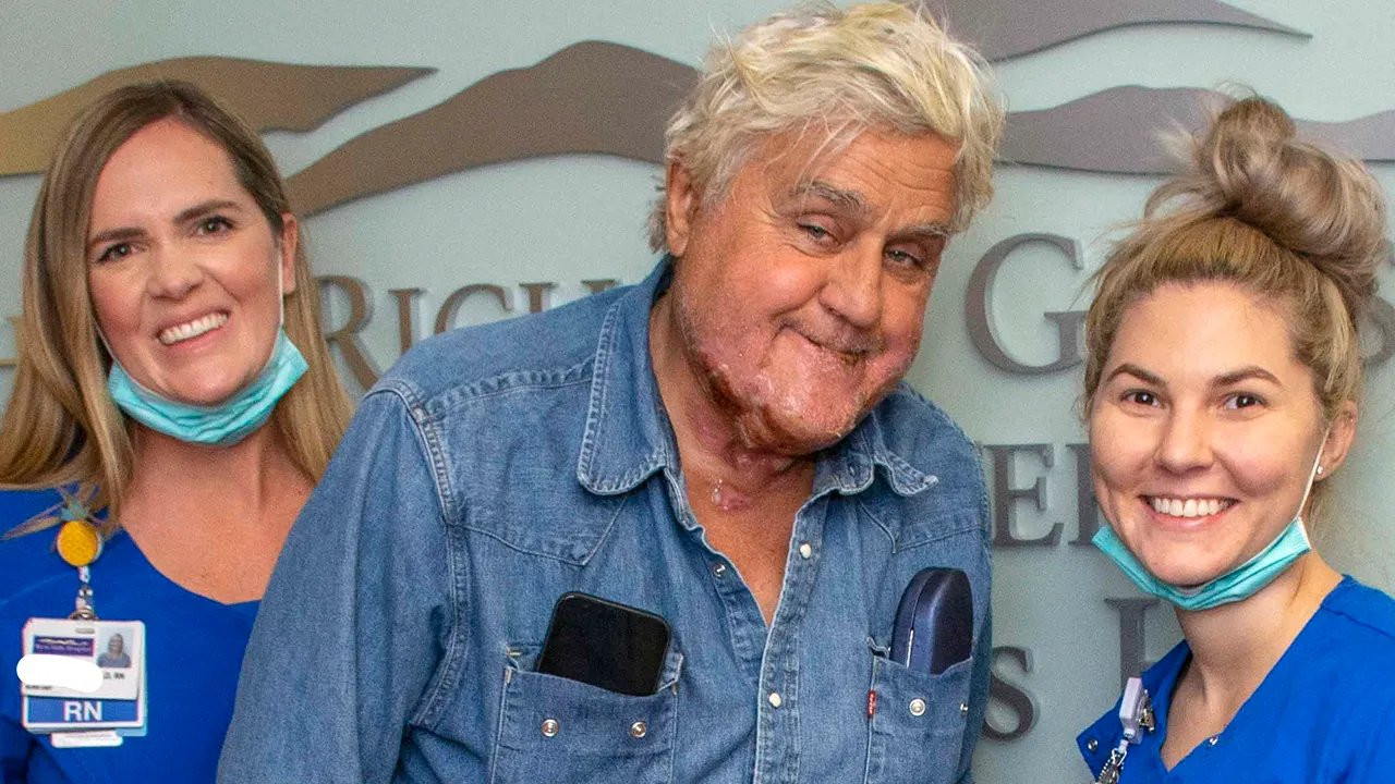 Garajındaki patlamada yaralanan Jay Leno taburcu oldu