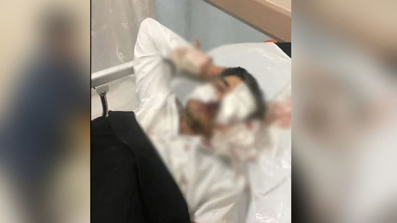 Sivas Ziraat Odası genel sekreteri saldırıya uğradı