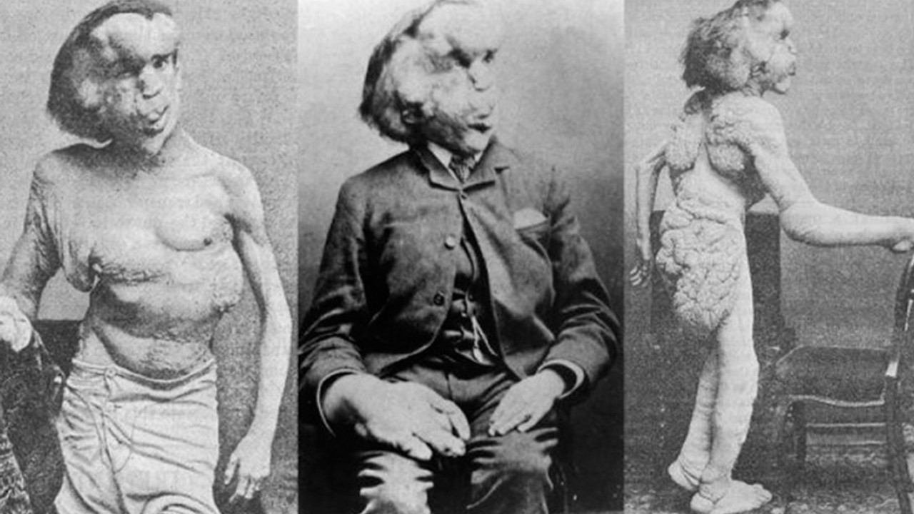 Fil Adam Joseph Merrick'in mezarı bulundu iddiası