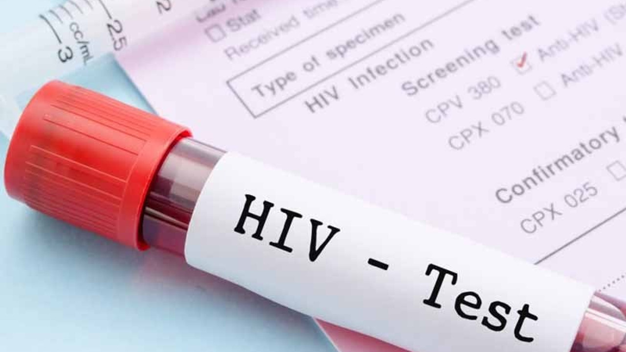 Nijerya'da her gün 47 çocuk ya da genç AIDS'ten ölüyor