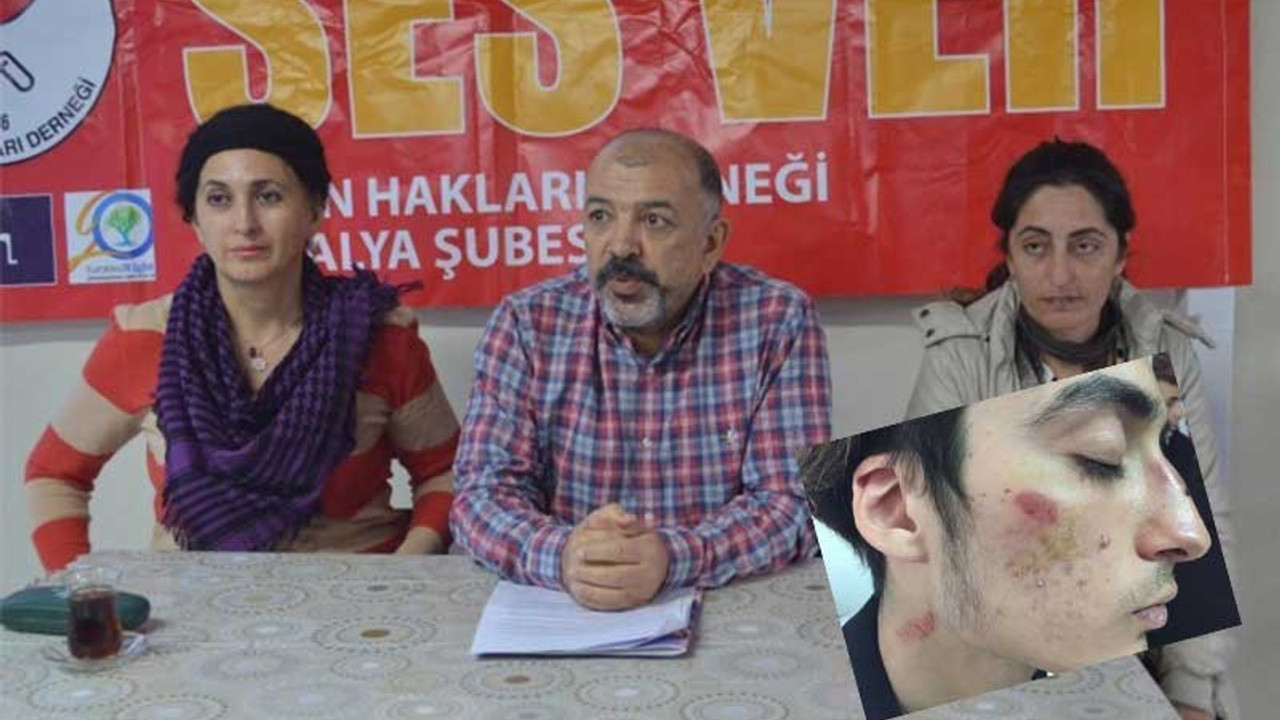 Irkçı saldırı sonrası 'basit yaralama' suçundan soruşturma açıldı