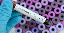 Bilim insanları, hangi kan grubunun koronavirüse karşı daha hassas olduğunu açıkladı