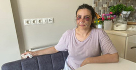 Derya Elbasan'a silahlı saldırıda bulunan eşi gözaltına alındı
