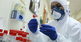 Sağlık Bakanlığı Coronavirus testi kriterlerini değiştiriyor