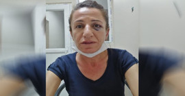 Gözaltında işkence