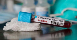 Türkiye'nin Coronavirus tablosu: 931'i pozitif tanı konuldu