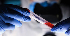 Türkiye'nin Coronavirus tablosu: 42.846 testten 928'i pozitif çıktı