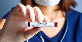 Türkiye'nin Coronavirus tablosu: Yeni vakalar artış eğiliminde