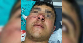 Havaya ateş açan polis, bir çocuğu yaraladı