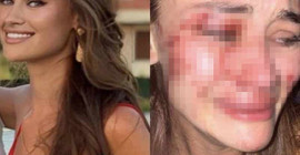 Ukraynalı model Kyryliuk'u darbettiği şüphesiyle gözaltına alınan kişi serbest bırakıldı