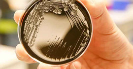 'Bakteriler gezegenler arasında yolculuk yapabiliyor'