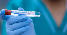 Coronavirus'u yenen servisçi: Bir ayda 20 kilo verdim, dayanılmaz acılar çektim
