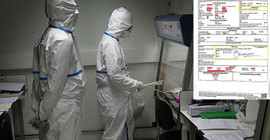 Coronavirus'ten ölen işçiyi, 'doğal ölüm' diye kaydettiler