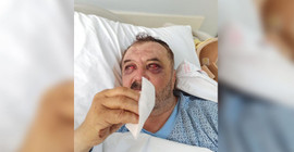 Gözaltına alınan köylülere işkence yapılmış