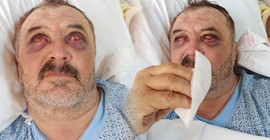 İşkence gören köylüler, tedavileri tamamlanmadan taburcu edilmeye çalışılıyor