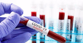 Bakan Koca açıkladı: Coronavirus hastalarına pozitif bileklik ve kutu uygulaması geliyor