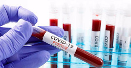 Araştırma: Coronavirus insan derisinde 9 saat kalabiliyor