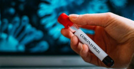 Coronavirus tablosu: 77 kişi daha yaşamını yitirdi