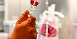 Coronavirus tablosu: Ağır hasta sayısı 3 bin 95'e çıktı