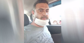 Boşandığı kadını öldüren erkek, ardından iki kadını daha vurdu