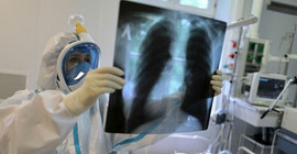 Coronavirus tablosu: 29 bin 845 pozitif vaka tespit edildi
