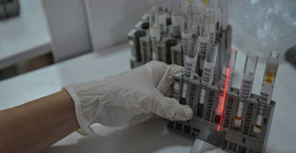 Test ihalesi Menzil tarikatına ait şirkete verildi: 144 milyon lira ödenecek