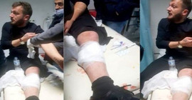 Polis trafikte iki yurttaşa kurşun sıktı