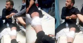 Hakkari'de iki kişi polis kurşunuyla yaralandı, Valilik 'tehlike arz etmeyecek şekilde ateş açıldı' dedi