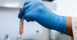 Coronavirus tablosu: 193 kişi daha yaşamını yitirdi