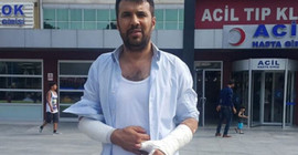 İnsan Hakları Dairesi Başkanlığı: Aydın Aydoğan'ı 'haklı gerekçeyle' dövmüşler