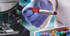 Coronavirus tablosu: Bugün 254 kişi daha yaşamını yitirdi
