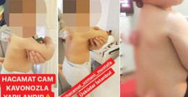 Üsküdar'da bir merkezde bebeklere hacamat yapıldığı ortaya çıktı