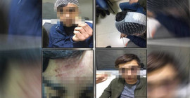 2 yıl sonra çocuklara işkence eden polislerin teşhisi istendi