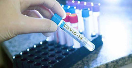 İspatlandı: Coronavirus, erkeklerde kalıcı kısırlığa neden oluyor