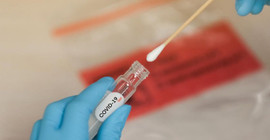 Bilim insanları, iki Coronavirus türünden gelen bir Coronavirus melezi keşfetti