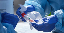 Coronavirus tablosu: 28 bin 731 vaka, 157 vefat