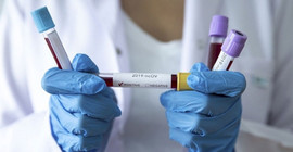 Evinde ölü bulunan kadının Coronavirus testi pozitif çıktı