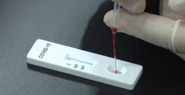 Uzmanlar, eczanelerde satışı yasaklanan hızlı Covid-19 test kitlerine karşı uyardı